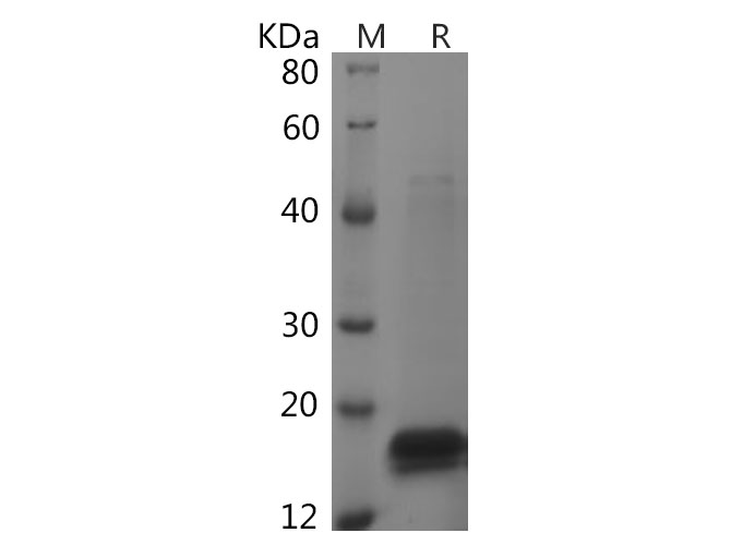 Recombinant Human FGF2 Protein(GST Tag)-产品推荐-1