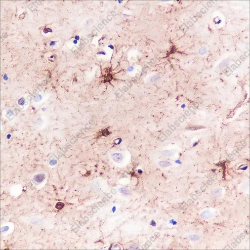 Recombinant S100A1 Monoclonal Antibody - 2