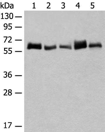 Western blot analysis of K562 and A172 cell Human bladder transitional cell carcinoma grade 2-3 tissue NIH/3T3 cell Mouse liver tissue lysates  using CCDC47 Polyclonal Antibody at dilution of 1:300