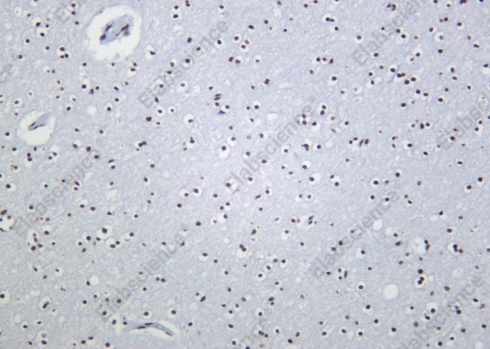 Recombinant Histone H3 (Acetyl Lys27) Monoclonal Antibody - 2