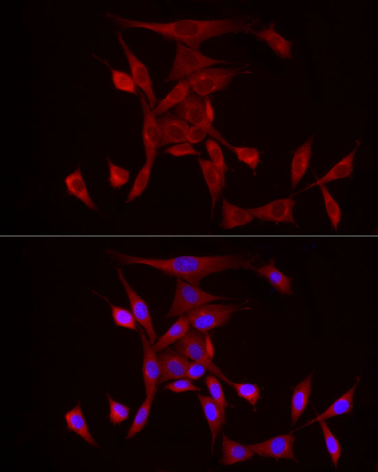 Immunofluorescence analysis of NIH/3T3 cells using PDE4A Polyclonal Antibody at dilution of 1:20 (40x lens). Blue: DAPI for nuclear staining.