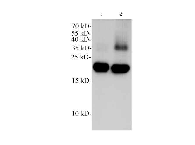 Western blotting with anti-POMC polyclonal Antibody at dilution of 1:1000. Lane 1: Mouse pituitary lysates, lane 2: Rat pituitary lysate.