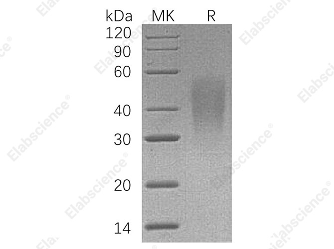 Recombinant Human LFA-3/CD58 Protein (His Tag) - 1