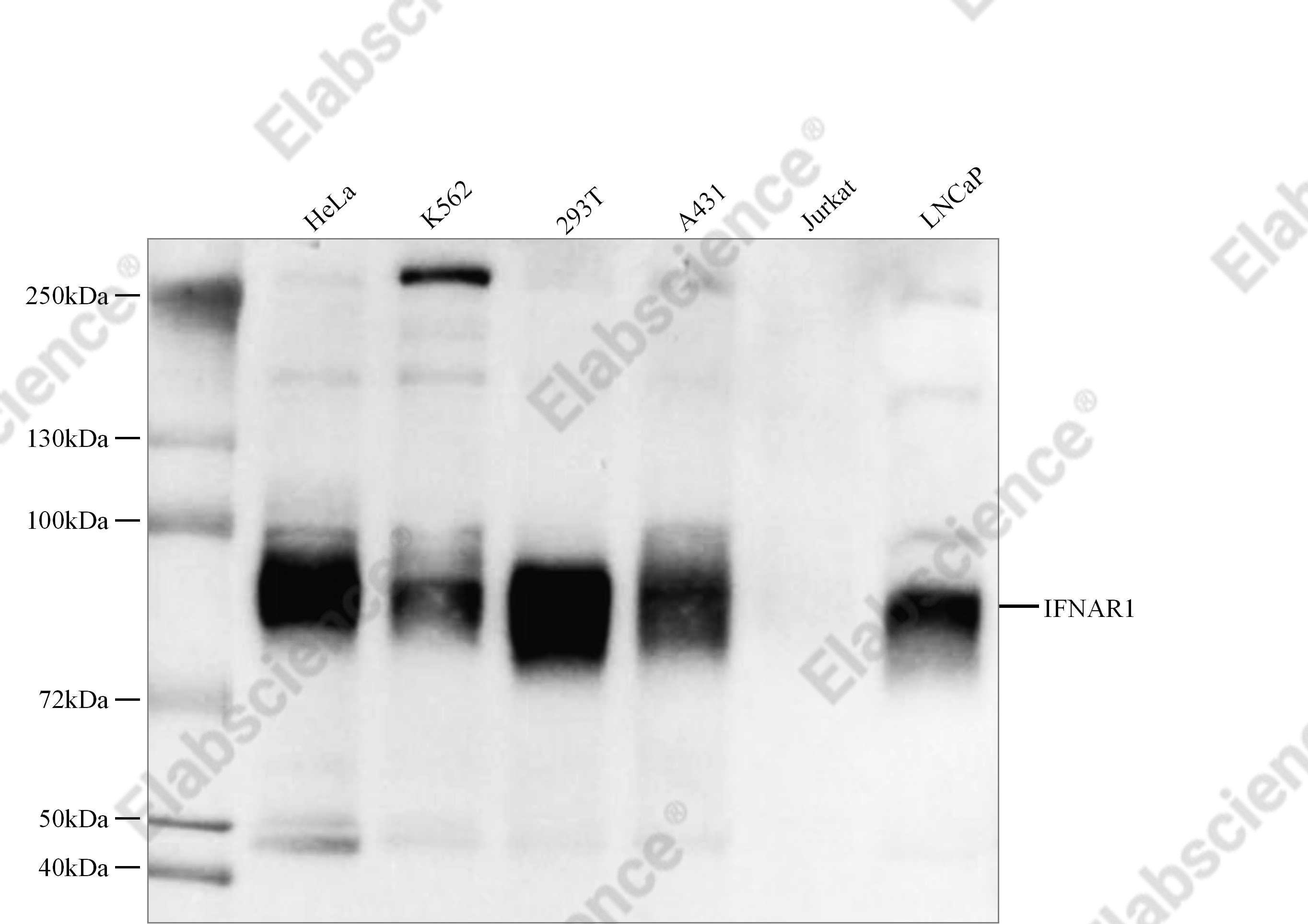 Recombinant IFNAR1 Monoclonal Antibody - 2