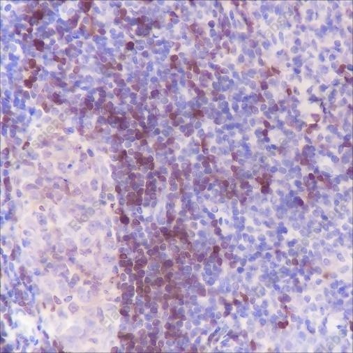 Recombinant TCL1 Monoclonal Antibody - 3