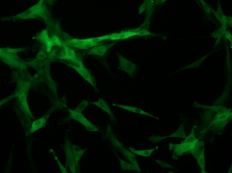 U-87 MG-GFP Cell Complete Medium - small - 11