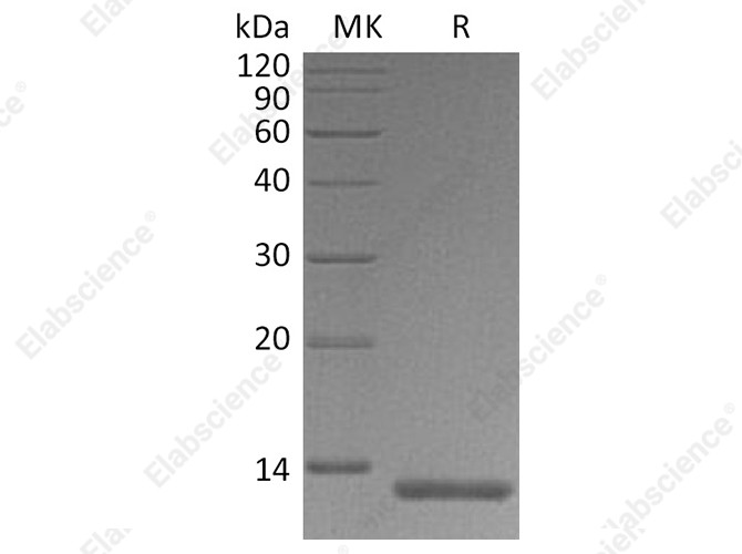 Recombinant Human S100A4 Protein (His Tag) - 1