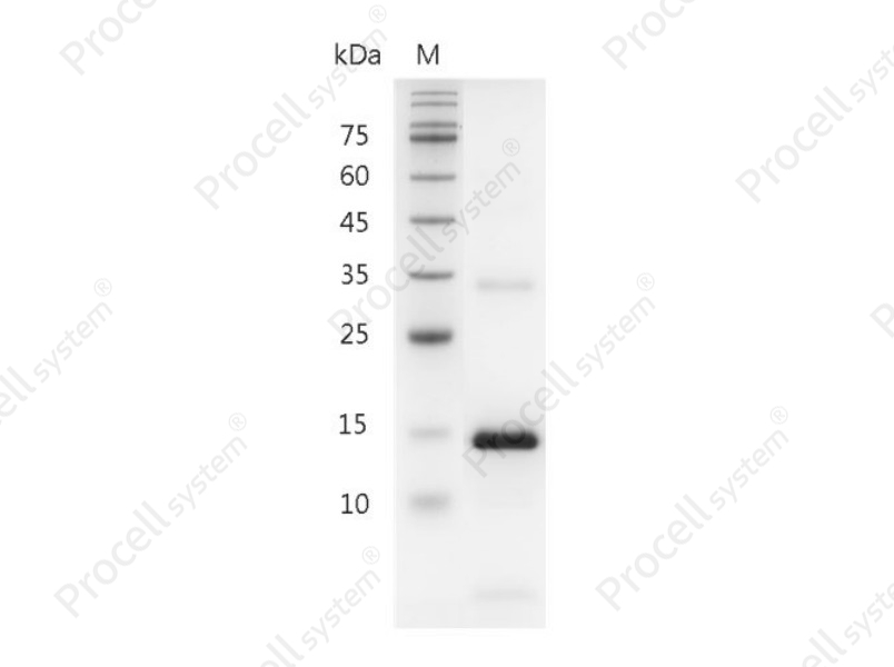 IL-21/Za11, Mouse, Recombinant