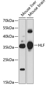 Western blot analysis of extracts of various cell lines using HLF Polyclonal Antibody at 1:1000 dilution.