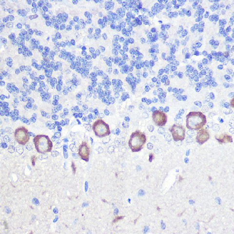 Immunohistochemistry of paraffin-embedded rat brain using PLC beta 3 Polyclonal Antibody at dilution of 1:100 (40x lens).Perform high pressure antigen retrieval with 10 mM citrate buffer pH 6.0 before commencing with IHC staining protocol.