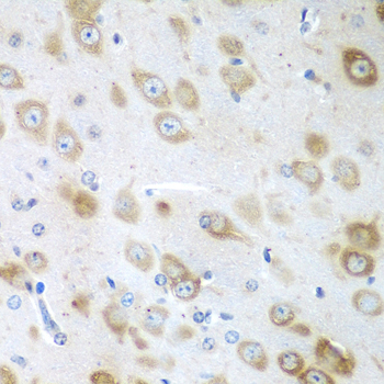 Immunohistochemistry of paraffin-embedded mouse brain using GFM1 Polyclonal Antibody at dilution of 1:100 (40x lens).Perform microwave antigen retrieval with 10 mM PBS buffer pH 7.2 before commencing with IHC staining protocol.