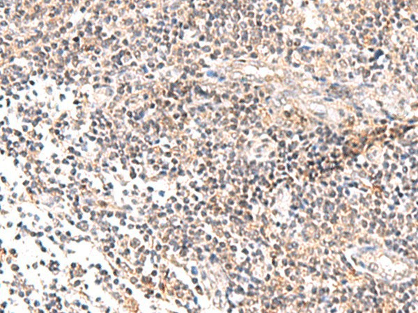 Immunohistochemistry of paraffin-embedded Human tonsil tissue  using IL36B Polyclonal Antibody at dilution of 1:40(?200)