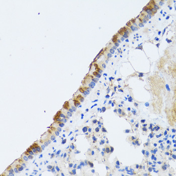 Immunohistochemistry of paraffin-embedded Rat lung using ST3GAL3 Polyclonal Antibody at dilution of 1:100 (40x lens).