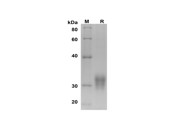Recombinant Rat IL1A/IL-1F1 Protein(His Tag)-产品推荐-1