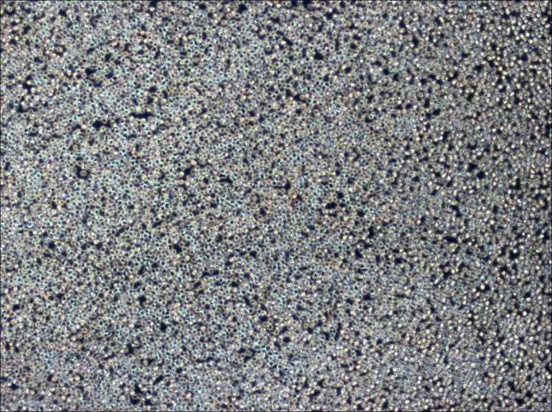 Z-138 Cell Complete MediumZ-138 Cell Complete Medium - 3