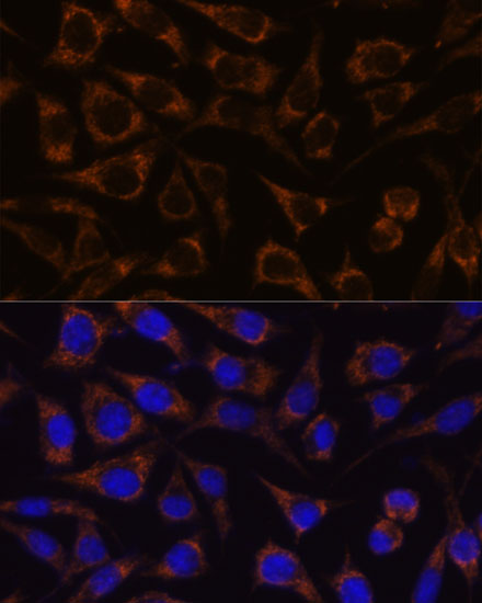 Immunofluorescence analysis of L929 cells using GTPBP8 Polyclonal Antibody at dilution of  1:100. Blue: DAPI for nuclear staining.