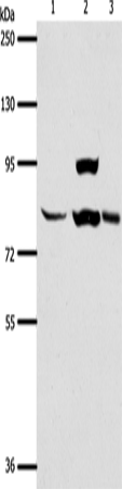 Western Blot analysis of Human liver cancer tissue, hela cell and Mouse lung tissue using AGAP1 Polyclonal Antibody at dilution of 1:400