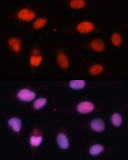 Immunofluorescence analysis of U-2 OS cells using MCM5 Polyclonal Antibody at dilution of  1:100. Blue: DAPI for nuclear staining.