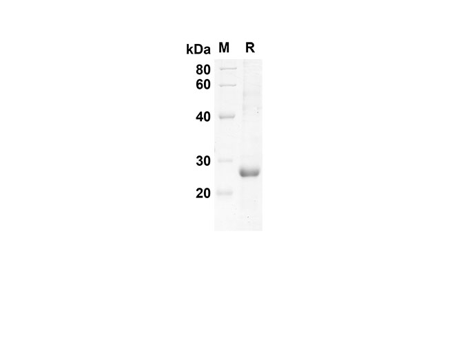 Recombinant Rat IL7R/IL-7R/CD127 Protein(His Tag)-产品推荐-1