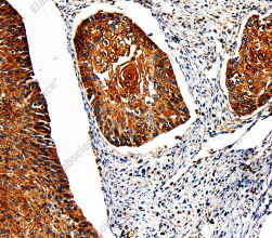 PKM Polyclonal Antibody - 2
