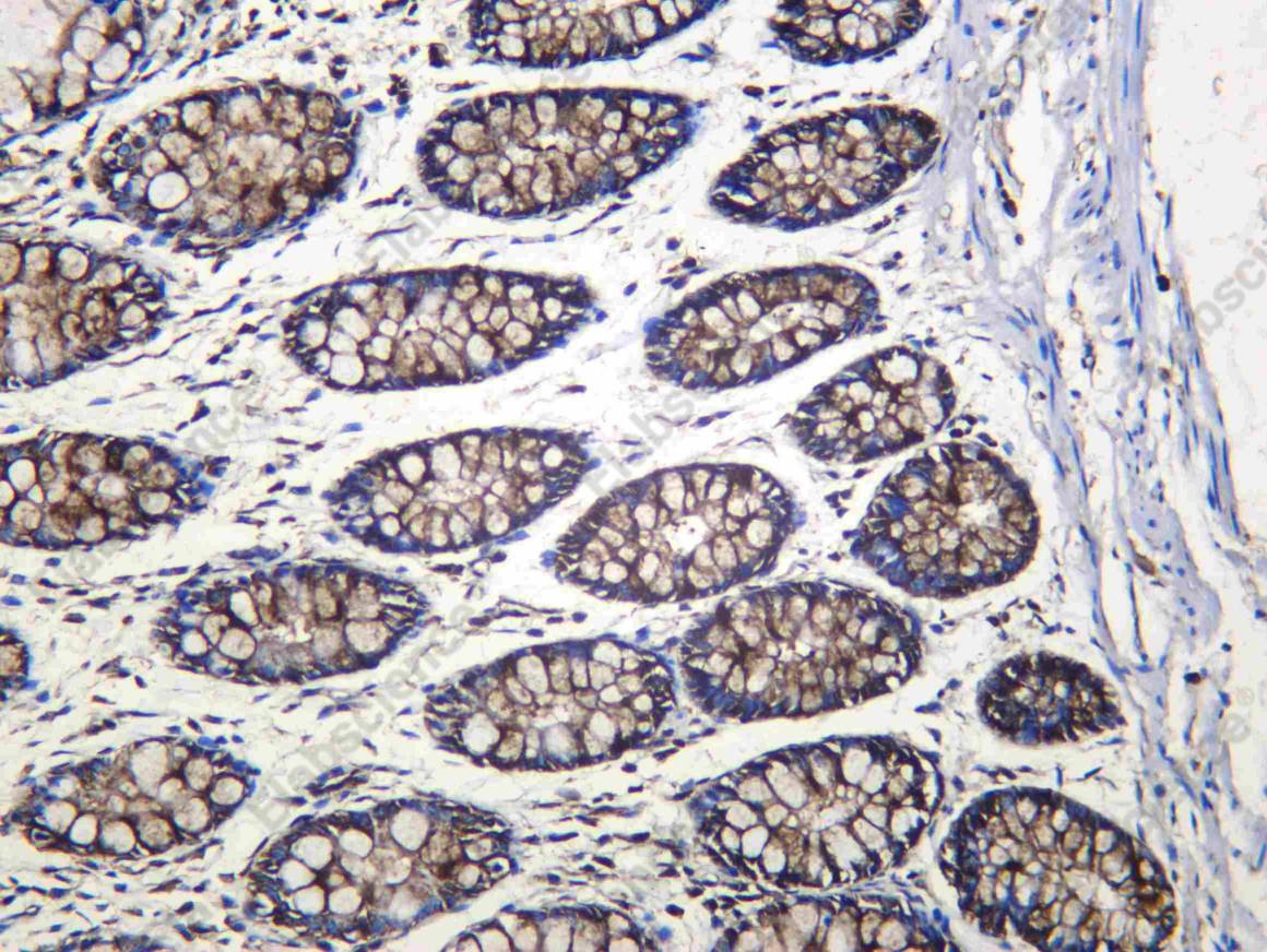 Recombinant EF-1 α1 Monoclonal Antibody - 1