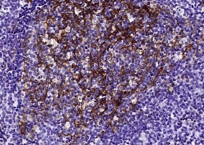 Recombinant CD23/FCER2 Monoclonal Antibody-searchlist-1