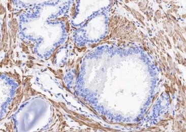 Recombinant Alpha Skeletal Muscle Actin Monoclonal Antibody-searchlist-2