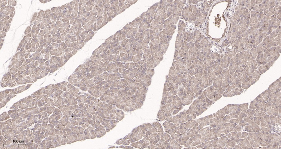 Recombinant PTEN Monoclonal Antibody - small - 2