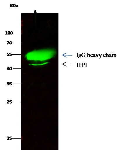 Recombinant TFPI/LACI/EPI Monoclonal Antibody - small - 1