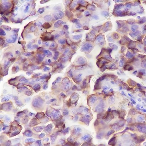 Recombinant NaPi2b Monoclonal Antibody - 1