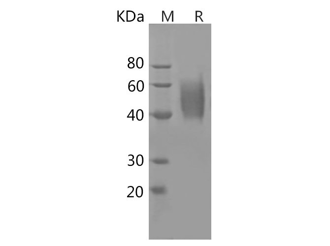 Recombinant Human TNFa Protein(Avi, His Tag)-产品推荐-1
