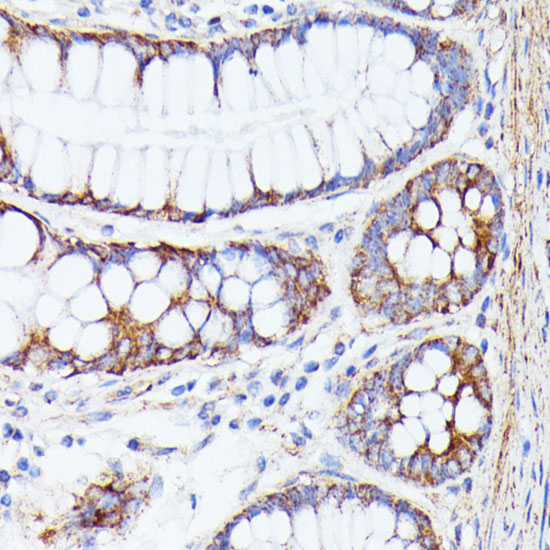 Immunohistochemistry of paraffin-embedded Human colon using PTP4A2 Polyclonal Antibody at dilution of  1:100 (40x lens).