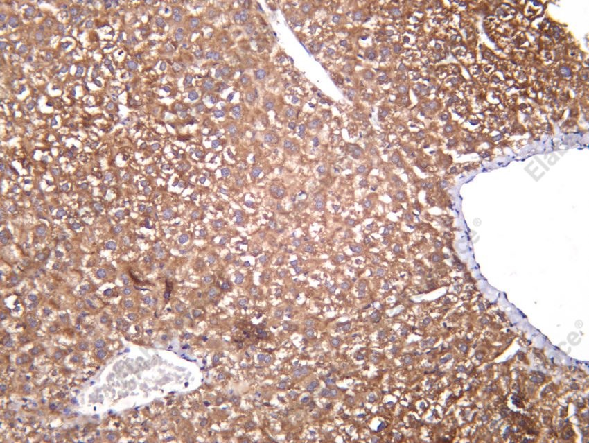 Recombinant IFNGR1/CD119/IFN-gamma-R1 Monoclonal Antibody - 2