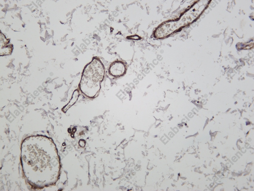 Recombinant α smooth muscle actin Monoclonal Antibody - 4
