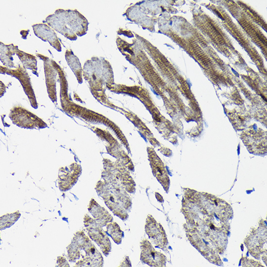 Immunohistochemistry of paraffin-embedded rat heart using Nesprin 1 Polyclonal Antibody at dilution of 1:100 (40x lens).Perform high pressure antigen retrieval with 10 mM citrate buffer pH 6.0 before commencing with IHC staining protocol.