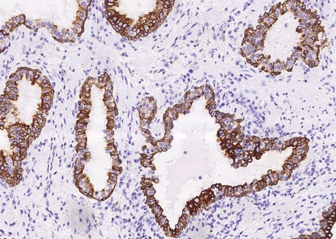 Cytokeratin 8 Monoclonal Antibody - small - 2
