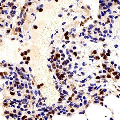 Immunohistochemistry analysis of paraffin-embedded mouse lung  using Galectin 3 Polyclonal Antibody at dilution of 1:300.