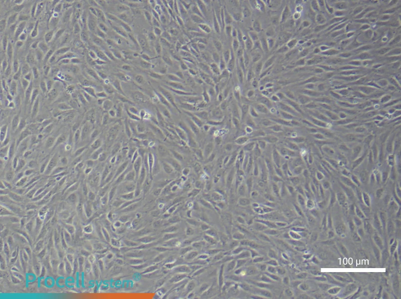 Human Endometrial Epithelial Cell Complete Medium - 2