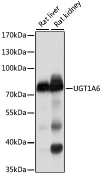 Western blot analysis of extracts of HepG2 cells using UGT1A6 Polyclonal Antibody at 1:1000 dilution.