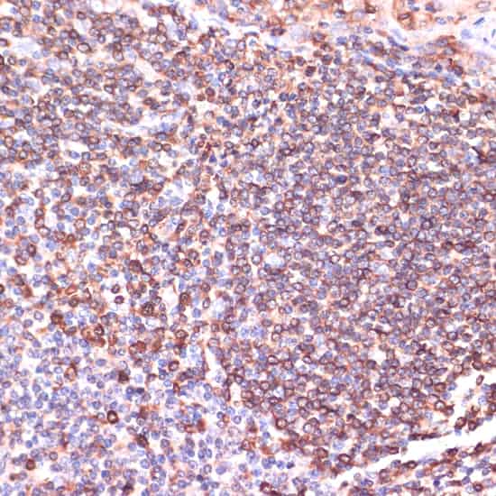 Immunohistochemistry of paraffin-embedded Human tonsil using TPD52 Polyclonal Antibody at dilution of 1:100 (40x lens).