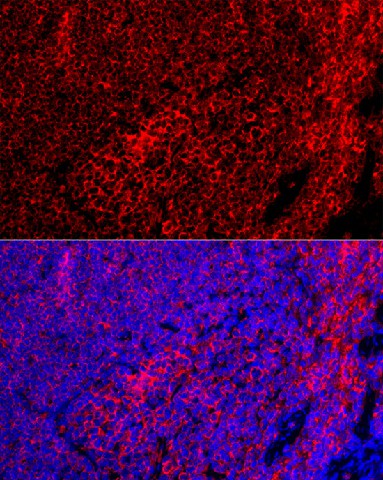 Immunofluorescence analysis of Mouse spleen using EMR1 Polyclonal Antibody at dilution of 1:100 (40x lens). Blue: DAPI for nuclear staining.