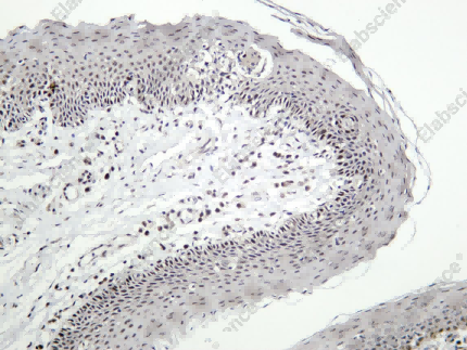 Recombinant p35 Monoclonal Antibody - 1