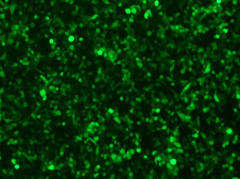 RM-1-GFP Cell Complete Medium - small - 9