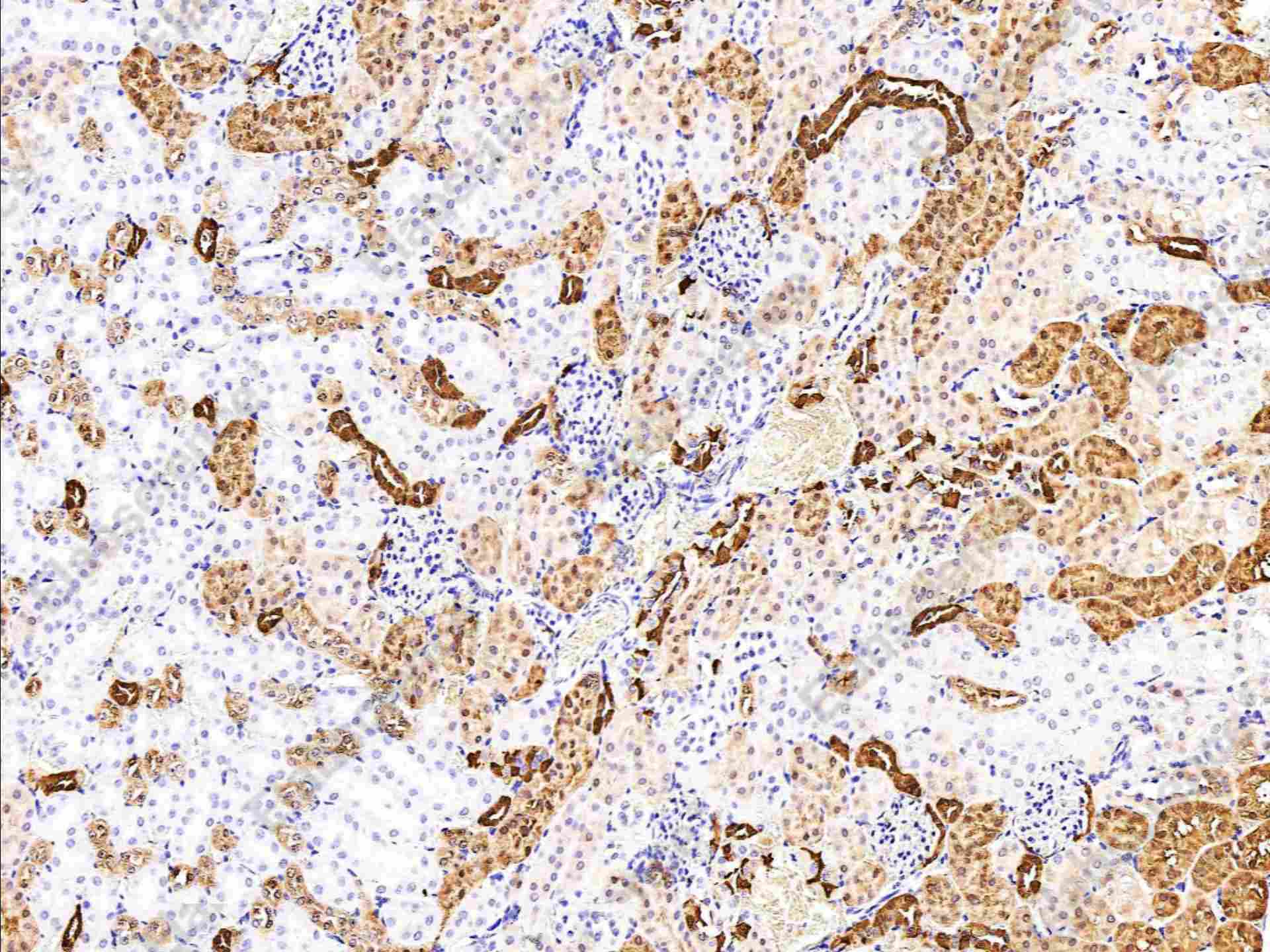 Recombinant Carbonic Anhydrase II/CA2 Monoclonal Antibody - 2
