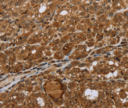 STMN2/3/4 Polyclonal Antibody - 2