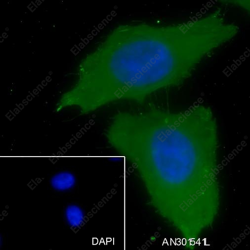 Recombinant GRK2 Monoclonal Antibody - 2