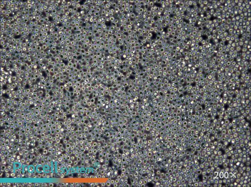 Z-138 Cell Complete Medium - 6