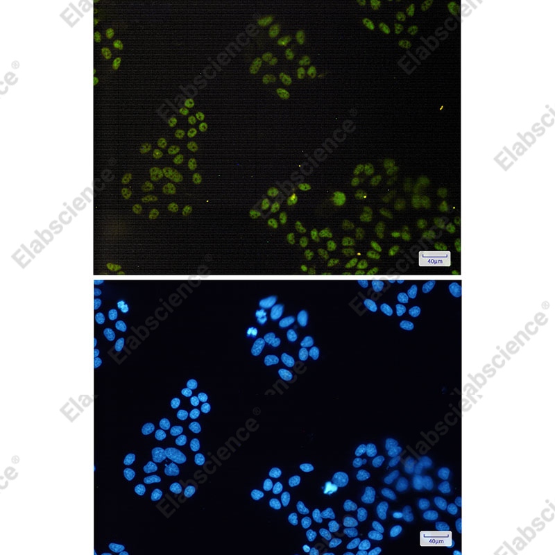 Recombinant CGBP Monoclonal Antibody - 2