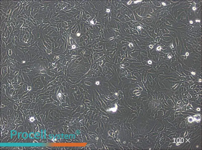 SK-GT-4 Cell Complete MediumSK-GT-4 Cell Complete Medium - 2