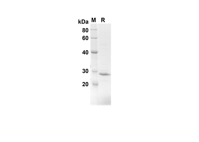 Recombinant Human CCL22 Protein-产品推荐-1